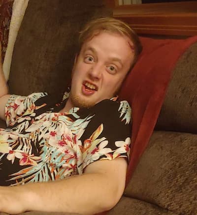 deranged white man floral shirt crazy eyes weird face